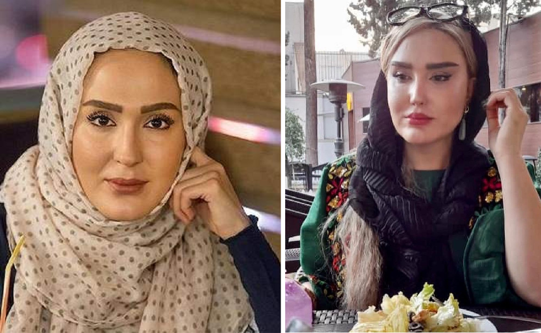 قبل و بعد از عمل زهره فکورصبور